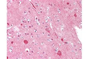 Anti-MYF5 / MYF 5 antibody IHC staining of human brain, cortex.