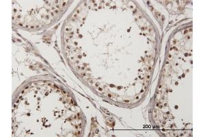 Immunoperoxidase of monoclonal antibody to CHEK2 on formalin-fixed paraffin-embedded human testis. (CHEK2 anticorps  (AA 1-543))