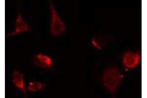 ABIN6267391 staining Hela by IF/ICC.