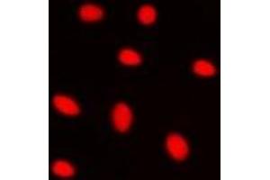 Immunofluorescent analysis of ZNF668 staining in HepG2 cells. (ZNF668 anticorps)
