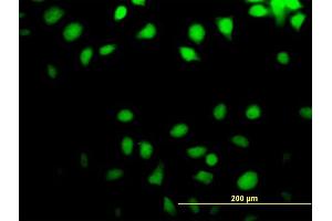 Immunofluorescence of purified MaxPab antibody to NT5C on HeLa cell.