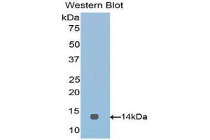 Western blot analysis of the recombinant protein. (VTCN1 anticorps  (AA 34-147))