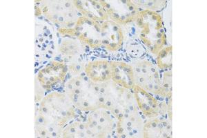 Immunohistochemistry of paraffin-embedded rat kidney using SLC39A7 antibody (ABIN5971725) at dilution of 1/100 (40x lens). (SLC39A7 anticorps)