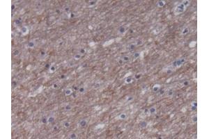 DAB staining on IHC-P; Samples: Human Cerebrum Tissue) (CKM anticorps)
