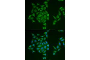 Immunofluorescence analysis of HeLa cell using AMPD3 antibody. (AMPD3 anticorps)