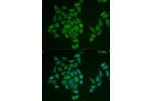 Immunofluorescence analysis of HeLa cell using AMPD3 antibody.