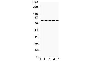 Western blot testing of Calpain antibody and Lane 1:  rat lung;  2: mouse lung;  3: human A549;  4: (h) COLO320;  5: (h) Jurkat. (Calpain anticorps  (Catalytic Subunit))