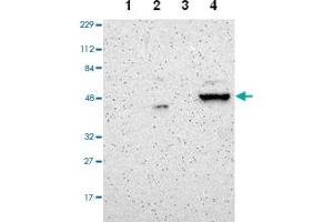 Western blot analysis of Lane 1: Human cell line RT-4, Lane 2: Human cell line U-251MG sp, Lane 3: Human plasma (IgG/HSA depleted), Lane 4: Human liver tissue with ZNF670 polyclonal antibody  at 1:100-1:250 dilution. (ZNF670 anticorps)