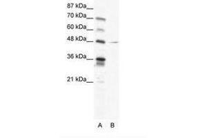 Image no. 1 for anti-Nuclear Factor I/C (CCAAT-Binding Transcription Factor) (NFIC) (AA 184-233) antibody (ABIN202501) (NFIC anticorps  (AA 184-233))