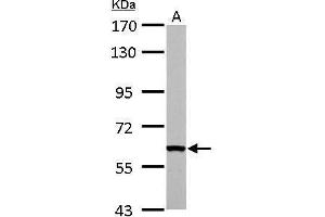 WB Image FAST antibody detects FASTK protein by Western blot analysis. (FASTK anticorps  (C-Term))
