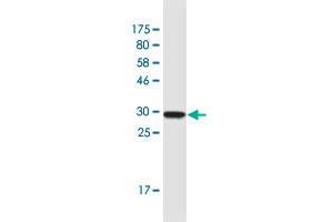 Western Blot detection against Immunogen (32. (CLTA anticorps  (AA 118-176))