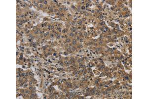 Immunohistochemistry of Human brain  using KIF4A Polyclonal Antibody at dilution of 1:40 (KIF4A anticorps)