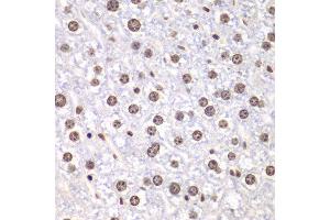 Immunohistochemistry of paraffin-embedded mouse liver using TOP1 antibody at dilution of 1:100 (400x lens). (Topoisomerase I anticorps)