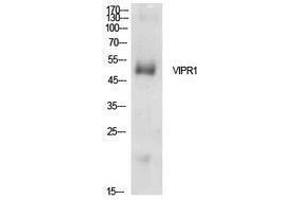 Western Blotting (WB) image for anti-Vasoactive Intestinal Peptide Receptor 1 (VIPR1) (Internal Region) antibody (ABIN3178920) (VIPR1 anticorps  (Internal Region))