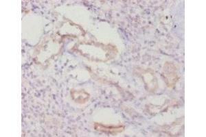 Immunohistochemistry of paraffin-embedded human kidney tissue using ABIN7146964 at dilution of 1:20