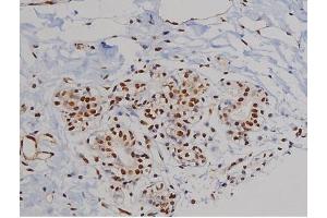 ABIN6267521 at 1/200 staining Human heart tissue sections by IHC-P.