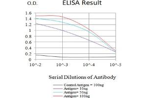 Black line: Control Antigen (100 ng),Purple line: Antigen (10 ng), Blue line: Antigen (50 ng), Red line:Antigen (100 ng)