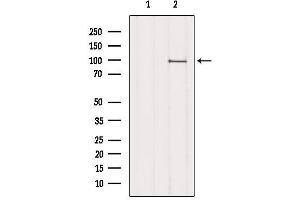 Western blot analysis of extracts from 3t3, using MPHOSPH8 Antibody. (MPHOSPH8 anticorps  (Internal Region))