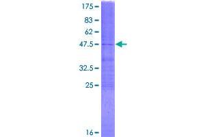 Image no. 1 for Methylmalonyl CoA Epimerase (MCEE) (AA 1-176) protein (GST tag) (ABIN1310535)