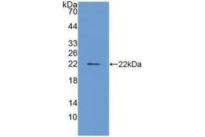 Detection of Recombinant FTL, Bovine using Polyclonal Antibody to Ferritin, Light Polypeptide (FTL)