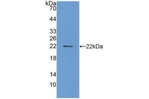 Detection of Recombinant FTL, Bovine using Polyclonal Antibody to Ferritin, Light Polypeptide (FTL) (FTL anticorps  (AA 1-175))