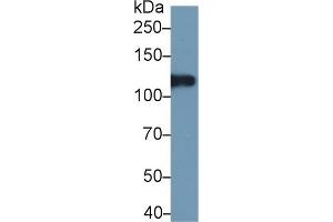 Detection of ITIH4 in Human Lung lysate using Polyclonal Antibody to Inter Alpha-Globulin Inhibitor H4 (ITIH4)