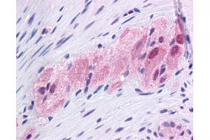 Immunohistochemistry (IHC) image for anti-Forkhead Box C1 (FOXC1) (N-Term) antibody (ABIN2780363)