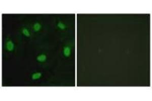 Immunofluorescence analysis of HeLa cells, using TBX15/18 antibody. (T-Box 15 anticorps)