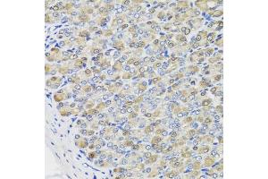 Immunohistochemistry of paraffin-embedded mouse stomach using CBR3 antibody (ABIN5975603) at dilution of 1/100 (40x lens). (CBR3 anticorps)
