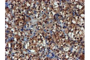 Image no. 4 for anti-Proteasome Subunit alpha 6 (PSMA6) antibody (ABIN1500464)