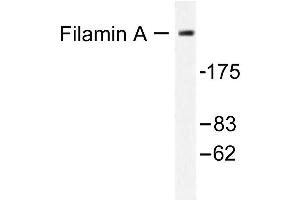 Image no. 1 for anti-Filamin A, alpha (FLNA) antibody (ABIN265421) (Filamin A anticorps)