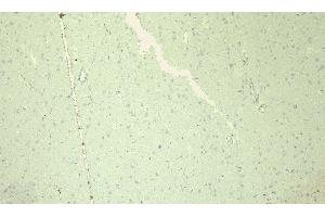 (ABIN185467) Negative Control showing staining of paraffin embedded Human Cortex, with no primary antibody.