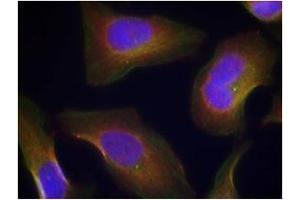 Image no. 3 for anti-Protein Kinase C, theta (PRKCQ) (pSer676) antibody (ABIN197070) (PKC theta anticorps  (pSer676))
