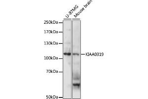 Western blot analysis of extracts of various cell lines, using KI antibody (ABIN7268112) at 1:1000 dilution. (KIAA0319 anticorps  (AA 21-300))