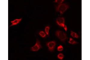 ABIN6274954 staining A549 by IF/ICC.