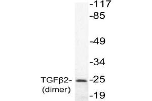 Image no. 1 for anti-Transforming Growth Factor, beta 2 (TGFB2) antibody (ABIN271850) (TGFB2 anticorps)