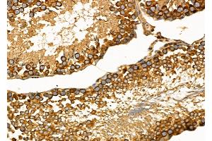 ABIN6260554 and ABIN6272679 at 1/100 staining Rat testis tissue by IHC-P. (CCR10 anticorps  (C-Term))