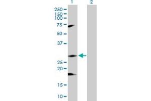 Western Blot analysis of IKBKB expression in transfected 293T cell line by IKBKB MaxPab polyclonal antibody.