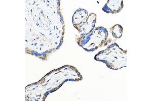 Immunohistochemistry of paraffin-embedded human placenta using LNPEP Rabbit pAb (ABIN6129286, ABIN6143284, ABIN6143285 and ABIN6215523) at dilution of 1:100 (40x lens). (LNPEP anticorps  (AA 1-110))