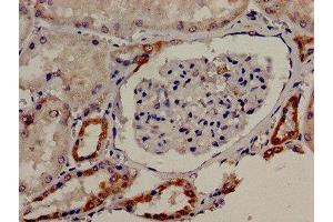 Immunocytochemistry analysis of human kidney tissue using ABIN7171654 at dilution of 1:100