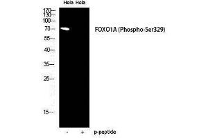 Western Blotting (WB) image for anti-Forkhead Box O1 (FOXO1) (pSer329) antibody (ABIN3173231) (FOXO1 anticorps  (pSer329))