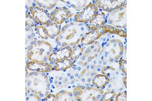 Immunohistochemistry of paraffin-embedded mouse kidney using PEX5 antibody (ABIN5973402) at dilution of 1/100 (40x lens). (PEX5 anticorps)
