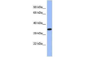 Host:  Rabbit  Target Name:  NR2E3  Sample Type:  OVCAR-3 Whole cell lysates  Antibody Dilution:  1.