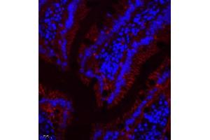Immunofluorescence of paraffin embedded rat small intestine using SLC7A8 (ABIN7074503) at dilution of 1:300 (400x lens)