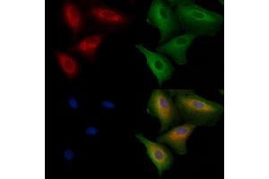 anti-Centrobin, Centrosomal BRCA2 Interacting Protein (CNTROB) (C-Term) antibody