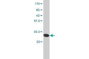 Western Blot detection against Immunogen (36. (Hexokinase 2 anticorps  (AA 818-917))