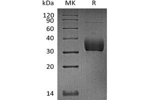 Western Blotting (WB) image for Sialic Acid Binding Ig-Like Lectin 15 (SIGLEC15) (Active) protein (His tag) (ABIN7321020)