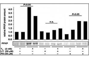 Image no. 2 for anti-phosphofructokinase, Platelet (PFKP) (C-Term) antibody (ABIN6749803) (PFKP anticorps  (C-Term))