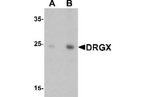 Western blot analysis of DRGX in rat liver tissue lysate with DRGX antibody at (A) 1 and (B) 2 µg/mL.