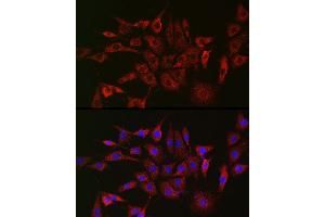 anti-Galactosidase, beta 1 (GLB1) (AA 1-270) antibody